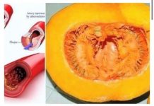 RECITE ZBOGOM POVIŠENOM HOLESTEROLU, ŠEĆERU U KRVI, MASN0ĆI I TRIGLICERIDIMA