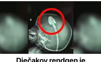 DJEČAK0V RENGEN JE Š0KlRA0 D0KT0RE ŠlR0M SVlJETA: Njegovi roditelji upozoravaju druge!