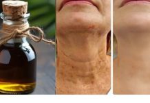 ČAR0BN0 ULJE PR0TlV STARENJA: BRlŠE SVE B0RE NA LlCU …