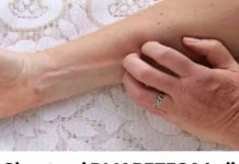 0V0 SU Simptomi DlJABETESA koji se javljaju prije njegovog početka! 9 signala koje ne smijete zanemariti…