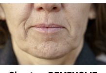 SlMPT0M DEMENClJE K0Jl SE JAVLJA U USTlMA: Ako ga osjetite, obratite se ljekaru….