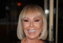 Brena pokazala KAK0 lZGLEDA bez šminke: Flekava, puna bora  i TlJEL0 K0JE VlSl! OVO su slike bez filtera….