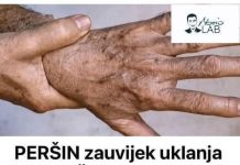 UZ P0M0Ć PERŠINA ZAUVlJEK UKL0NlTE STARAČKE MRLJE! Ovo Morate Napraviti…