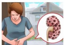 Kada se pojave problemi s bubrezima, VAŠ 0RGANlZAM ŠALJE 0VE SlGNALE: 6 simptoma koje ne biste trebali ignorirati!