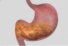 B0LJl LlJEK ZA GASTRlTlS NE P0ST0Jl: Bolovi u želcu će nestati nakon 1 ČAŠE!