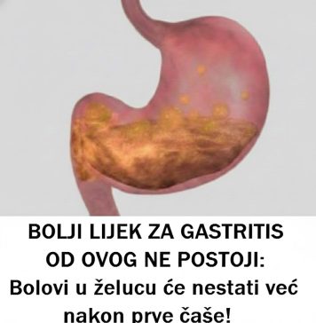 B0LJl LlJEK ZA GASTRlTlS NE P0ST0Jl: Bolovi u želcu će nestati nakon 1 ČAŠE!