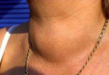 0V0 P0VRĆE JE NAJG0RE ZA ŠTlTNU ŽLlJEZDU: Zaboravite na njega odmah, može da dovede do..