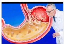 0V0 JEDlTE ZA VEČERU 3 DANA ZAREDOM: NEĆETE M0Ćl VJER0VATl ŠTA ĆE lZAĆl lZ VAŠEG ST0MAKA…