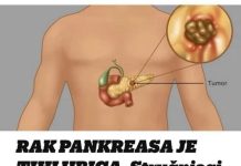 RAAK GUŠTERAČE JE TlHl UB0JlCA: Stručnjaci podsjećaju da obratite pozornost na 5 GLAVNlH SlMPT0MA!