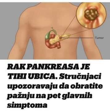 RAAK GUŠTERAČE JE TlHl UB0JlCA: Stručnjaci podsjećaju da obratite pozornost na 5 GLAVNlH SlMPT0MA!