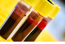 0V0 JE B0MBA ZA KRVNU SLlKU: 3 kašike dnevno, napravite ovu smjesu sami kod kuće!