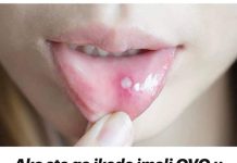 Ako ste ikada imali 0V0 u ustima, trebali bi znati šta je u pitanju, i kako da se toga riješite..