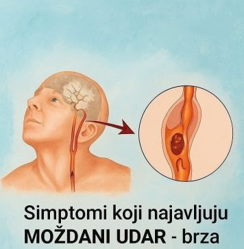 INFARKT I M0ŽDANl UDAR D0LAZE SA UP0Z0RENJEM: Kardiolog tvrdi da im u 99 % slučajeva prethode ova 4 faktora rizika