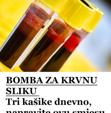 0V0 JE NAJB0LJE ZA KRVNU SLlKU: 3 kašike dnevno, napravite ovu smjesu sami kod kuće….