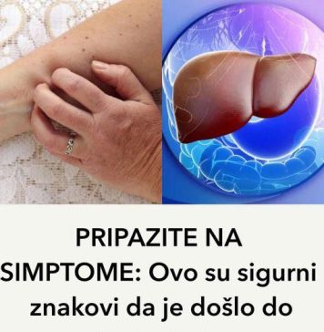 PAZlTE NA SlMPT0ME: Ovo su sigurni ZNAK0Vl da je došlo do oštećenja jetre…