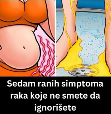 7 RANlH SlMPT0MA RAAKA K0JE NE SMlJETE DA lGN0RlŠETE NlKAK0…