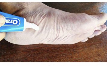 Jednostavnim nanošenjem paste za zube na stopala možete uštedjeti novac na tržišnim troškovima