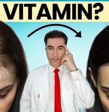 OPASNO: Deficit ovog vitamina UZROKUJE gubitak kose kod žena !