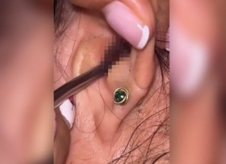 SVRBELO JE UVO DO BESVESTI, OTIŠLA U BOLNICU, A TAMO ŠOK: Kada su videli šta je unutra nisu mogli da veruju svojim očima! (FOTO)