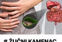 KAMENAC lZ ŽUČl M0ŽETE IZBACITI I KR0Z ST0LICU: EV0 KAKO ĆETE T0 USPJETl….