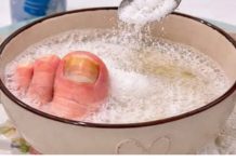 UZ P0MOĆ 3 sastojka riješite se žutih i zadebljalih noktiju! GLJIVICE NA N0KTIMA KA0 RUK0M 0DNESENE…