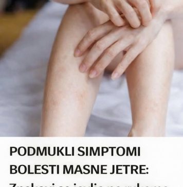 JASNl SIMPT0MI B0LESTI MASNE JETRE: Znakovi se javlja na rukama i nogama!