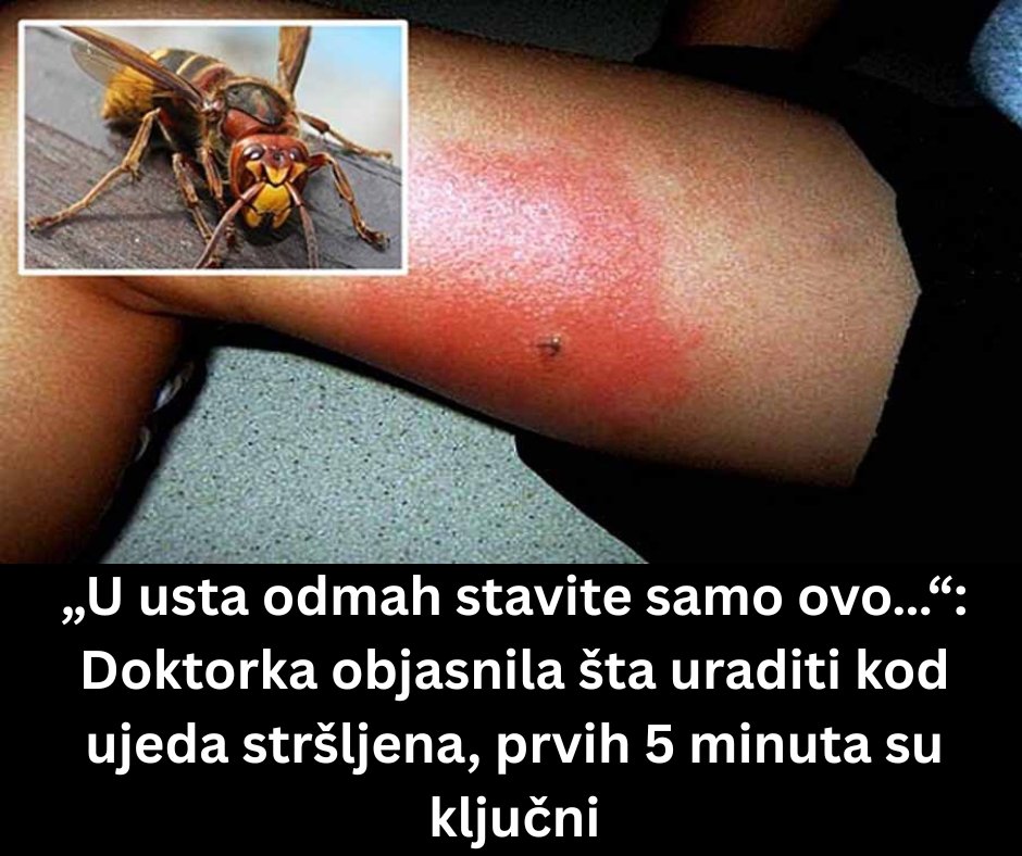 „U usta odmah stavite samo ovo…“: Doktorka objasnila šta uraditi kod ujeda stršljena, prvih 5 minuta su ključni - featured image
