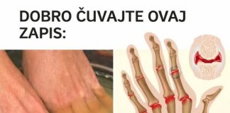 Bolovi u zglobovima ruku i nogu simptomi i lečenje - featured image