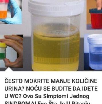 Često mokrite manje količine urina? Noću se budite da idete u wc? Ovo su simptomi jednog sindroma! Evo šta je u pitanju - featured image