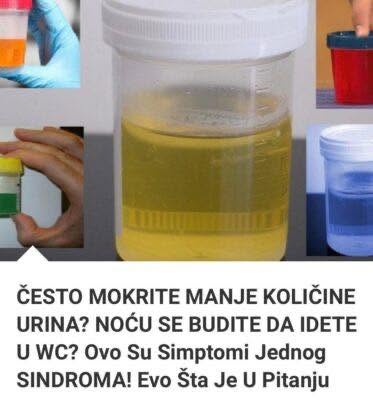 Često mokrite manje količine urina? Noću se budite da idete u wc? Ovo su simptomi jednog sindroma! Evo šta je u pitanju - featured image
