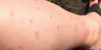 KOMARCI VAM PRAVE PAKAO OD ŽIVOTA? Samo isijecite OVO VOĆE na pola i ostavite u sobi, VIŠE IH NIKADA NEĆETE VIDJETI BLIZU! - featured image