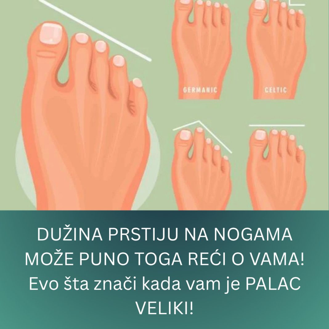 DUŽINA PRSTIJU NA NOGAMA MOŽE PUNO TOGA REĆI O VAMA! Evo šta znači kada vam je PALAC VELIKI! - featured image