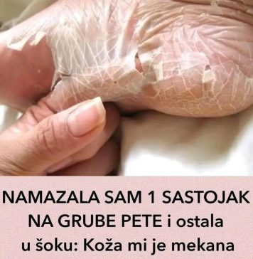NAMAZALA SAM 1 SASTOJAK NA GRUBE PETE I OSTALA U ŠOKU NAMAZALA SAM 1 SASTOJAK NA GRUBE PETE I OSTALA U ŠOKU - featured image