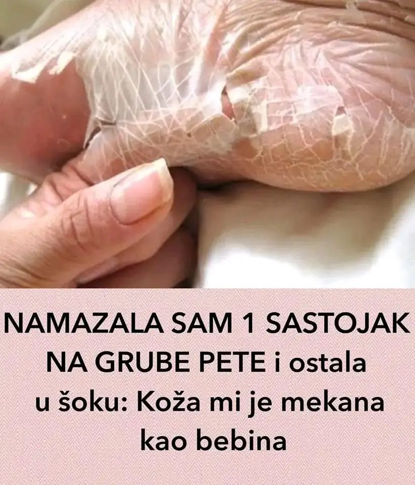 NAMAZALA SAM 1 SASTOJAK NA GRUBE PETE I OSTALA U ŠOKU - featured image NAMAZALA SAM 1 SASTOJAK NA GRUBE PETE I OSTALA U ŠOKU - featured image