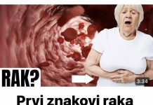 Prvi znakovi raka debelog crijeva koje žene ignoriraju! - featured image