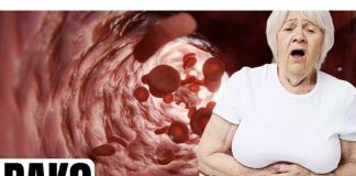 Prvi znakovi raka debelog crijeva koje žene ignoriraju! - featured image