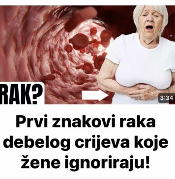 Prvi znakovi raka debelog crijeva koje žene ignoriraju! Prvi znakovi raka debelog crijeva koje žene ignoriraju! - featured image
