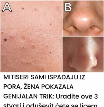 MITISERI SAMI ISPADAJU IZ PORA, ŽENA POKAZALA GENIJALAN TRIK: Uradite ove 3 stvari i oduševit ćete se licem - featured image