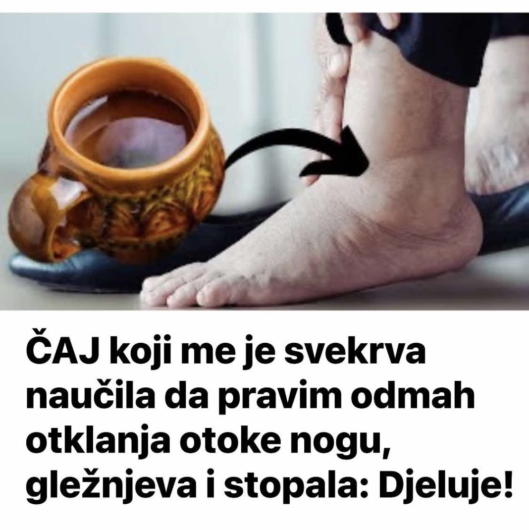 ČAJ koji me je svekrva naučila da pravim odmah otklanja otoke nogu, gležnjeva i stopala: Djeluje! - featured image ČAJ koji me je svekrva naučila da pravim odmah otklanja otoke nogu, gležnjeva i stopala: Djeluje! - featured image