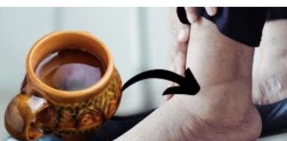 ČAJ koji me je svekrva naučila da pravim odmah otklanja otoke nogu, gležnjeva i stopala: Djeluje! - featured image
