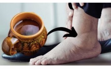 ČAJ koji me je svekrva naučila da pravim odmah otklanja otoke nogu, gležnjeva i stopala: Djeluje! - featured image