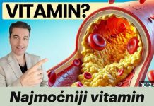 Najmoćniji vitamin za čišćenje arterija nakon 50. godine! - featured image