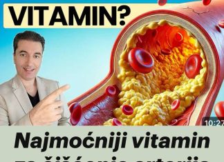 Najmoćniji vitamin za čišćenje arterija nakon 50. godine! - featured image