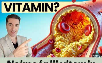 Najmoćniji vitamin za čišćenje arterija nakon 50. godine! - featured image
