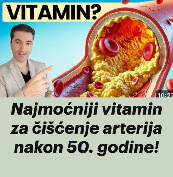 Najmoćniji vitamin za čišćenje arterija nakon 50. godine! - featured image