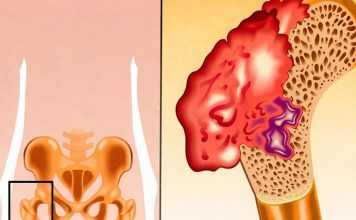 Bol u kostima, visok pritisak i tuga: Tijelo vam govori da mu NEDOSTAJE ovaj važan VITAMIN - featured image
