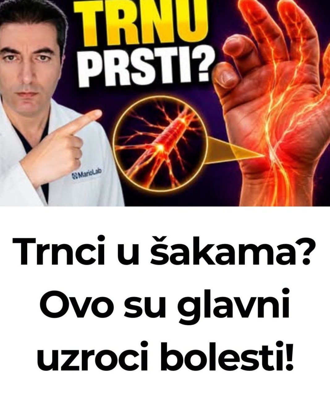 Trnci u šakama? Ovo su glavni uzroci bolesti! - featured image Trnci u šakama? Ovo su glavni uzroci bolesti! - featured image