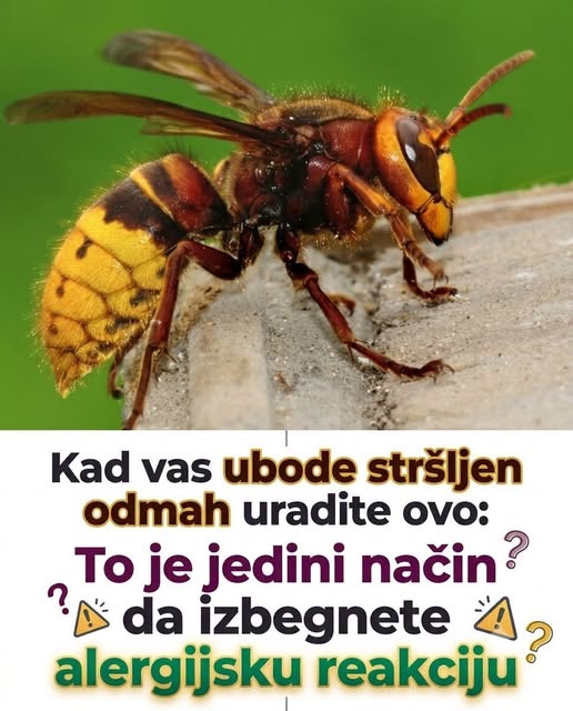 Kad vas ubode stršljen odmah uradite ovo: To je jedini način da izbegnete alergijsku reakciju - featured image