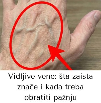Ako imaš vidljive vene, to značI da si… - featured image