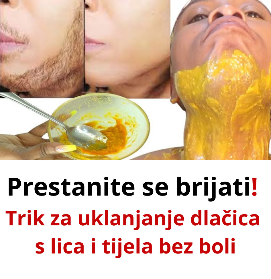 Prestanite se brijati! Super trik za najlakši način za uklanjanje dlačica s lica i tijela bez boli! - featured image Prestanite se brijati! Super trik za najlakši način za uklanjanje dlačica s lica i tijela bez boli! - featured image